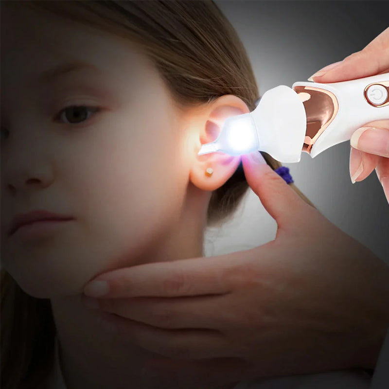5-in-1 Electric Ear Wax Remover