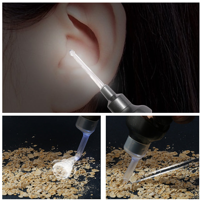 5-in-1 Electric Ear Wax Remover